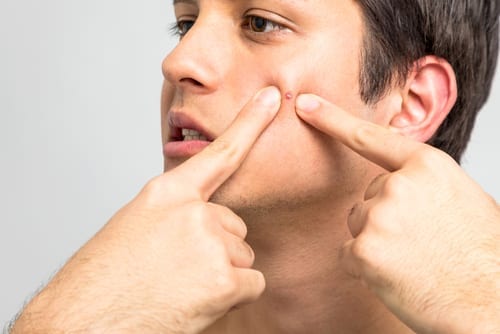 A man is touching his face to the side.