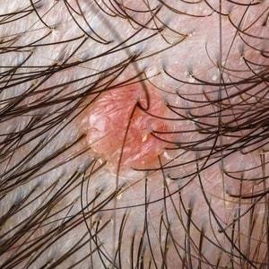 A close up of the hair on a person 's head.