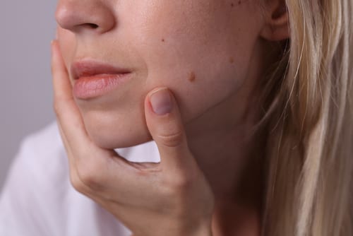 A woman with her hand on her face.